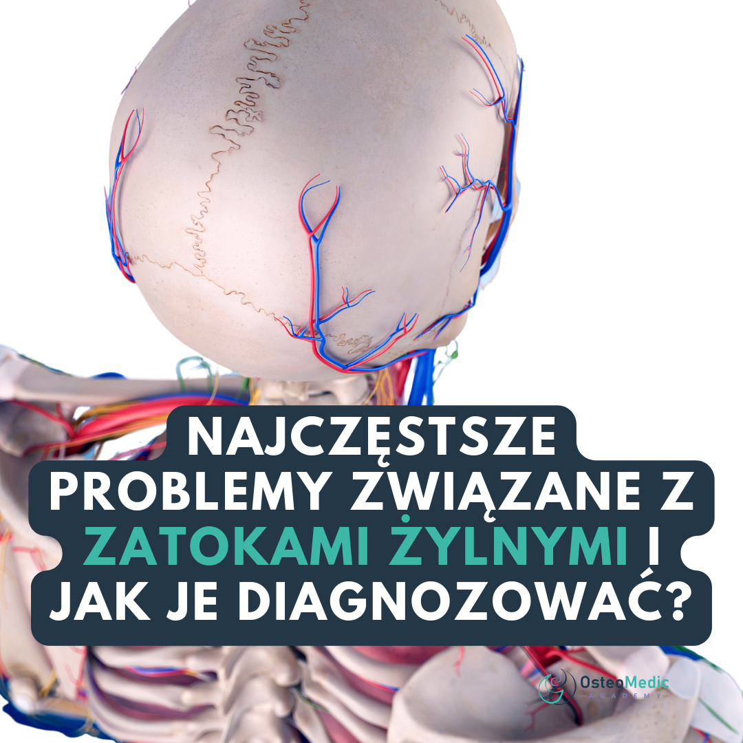 Zdjęcie wpisu na blogu